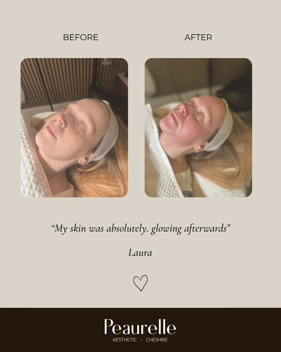 Peaurelle facial client feedback card